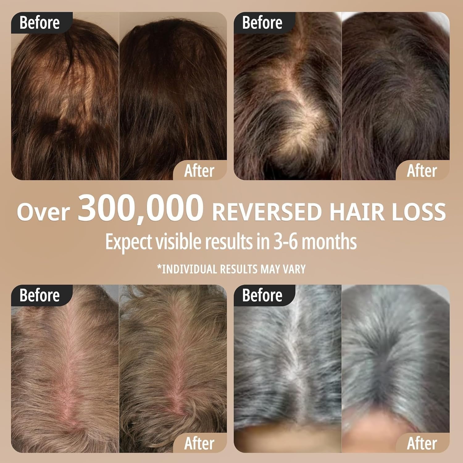 Cordless Laser Hair Regrowth Device with Red Light Therapy & Scalp Massage