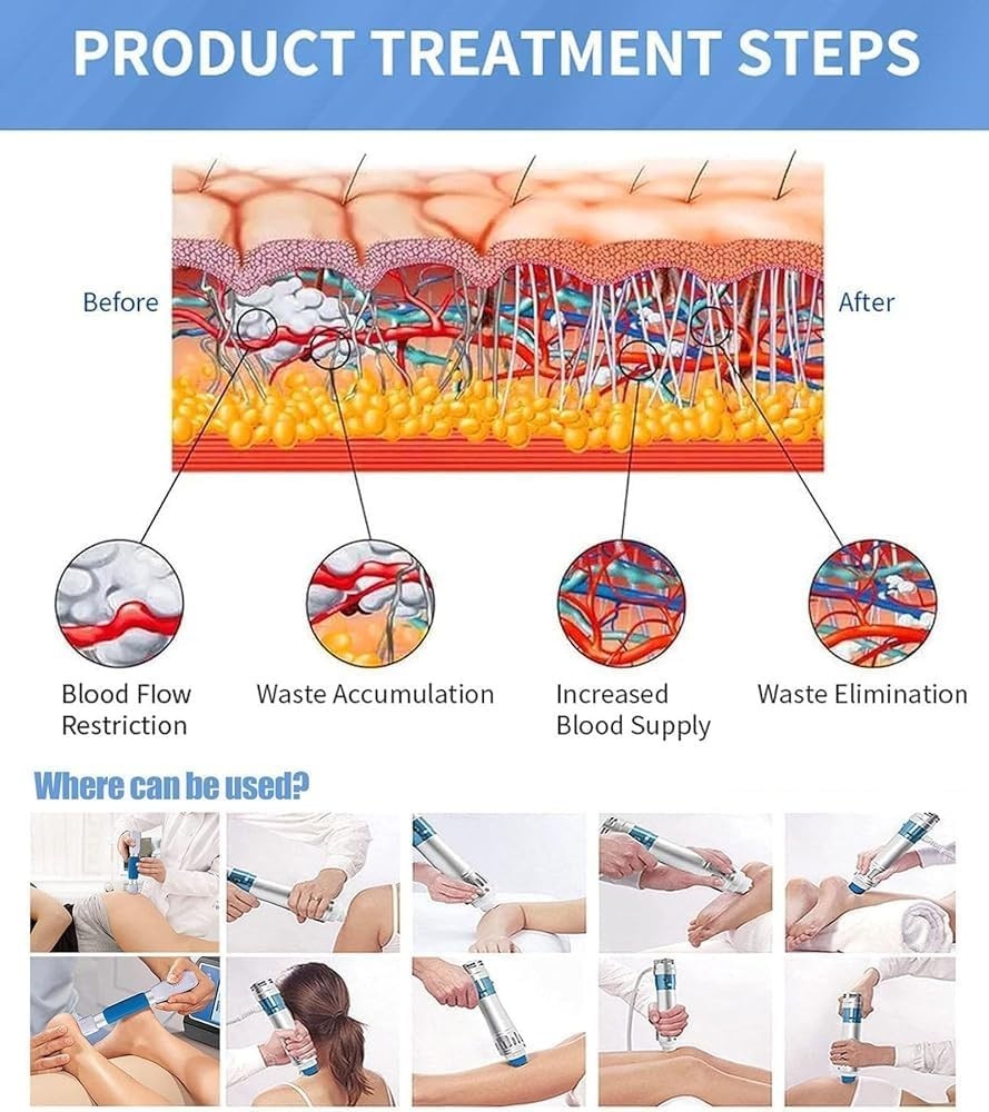 Shockwave Therapy Machine for Pain Relief & Muscle Recovery Physiotherapy Kit