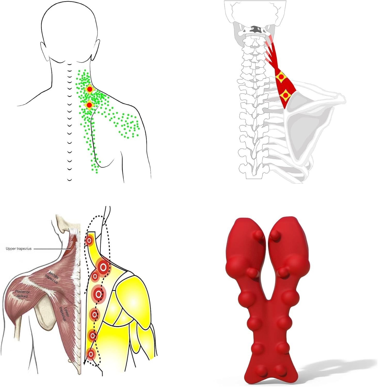 Trigger Point Massager for Neck & Shoulder Pain Relief, Myofascial Release