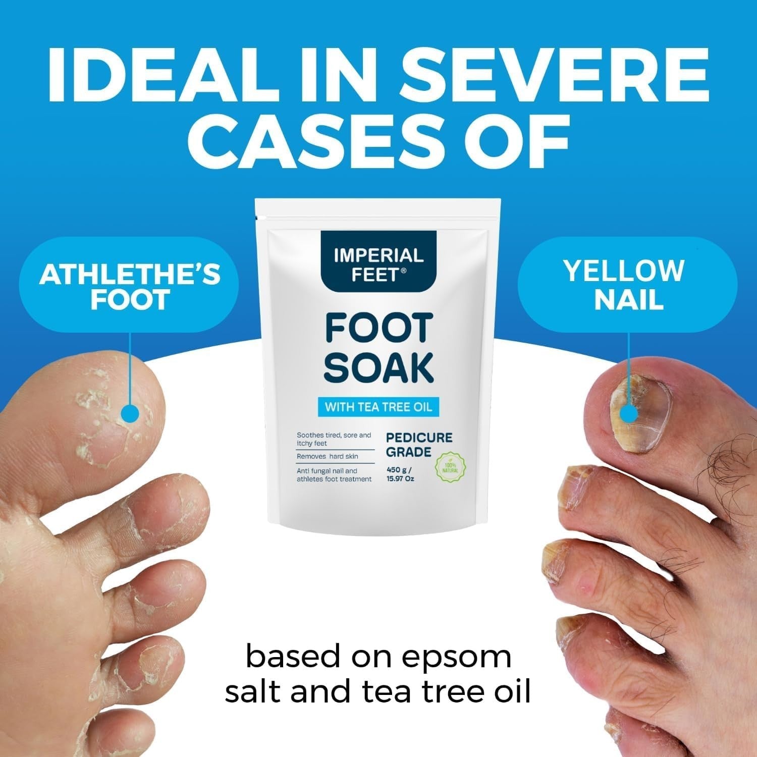 Heated Foot Spa Soak w/ Rollers Bubbles Epsom Salt Pedicure