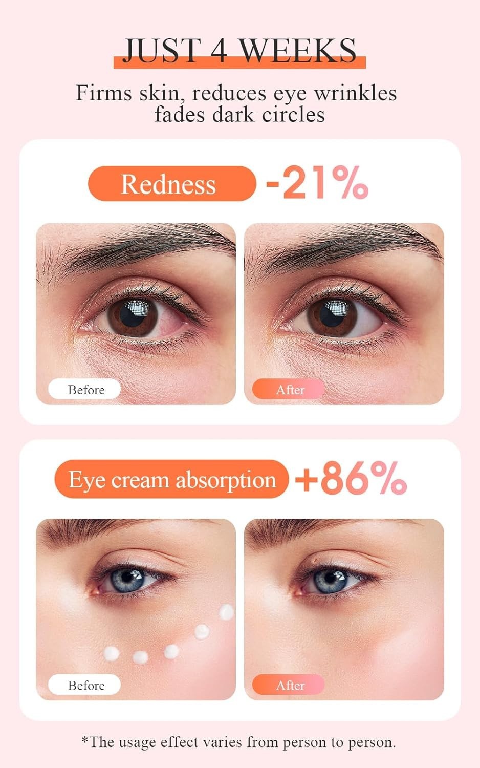 EMS Heated Eye Massager Microcurrent Fine Line Puffiness Relief
