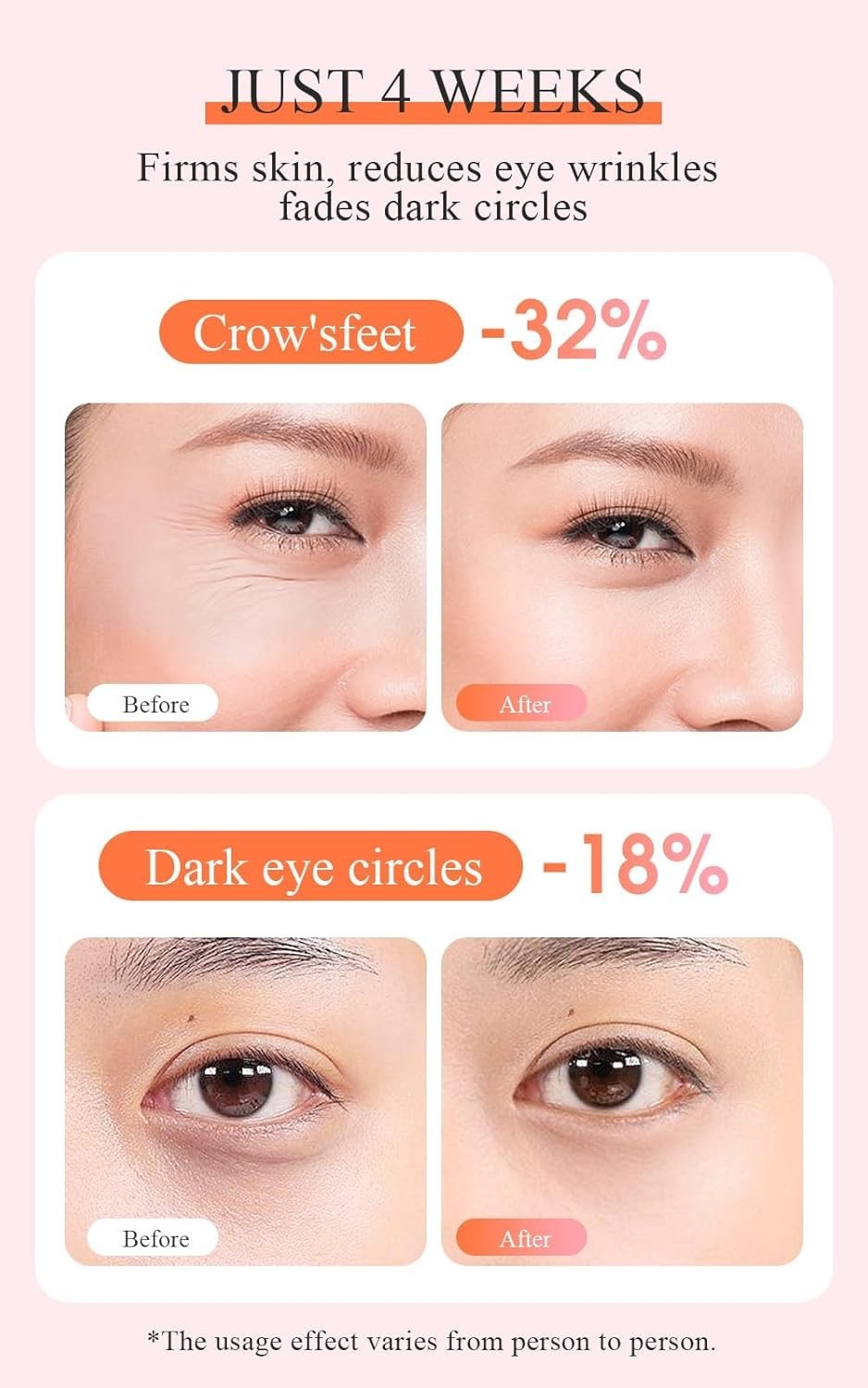 EMS Heated Eye Massager Microcurrent Fine Line Puffiness Relief