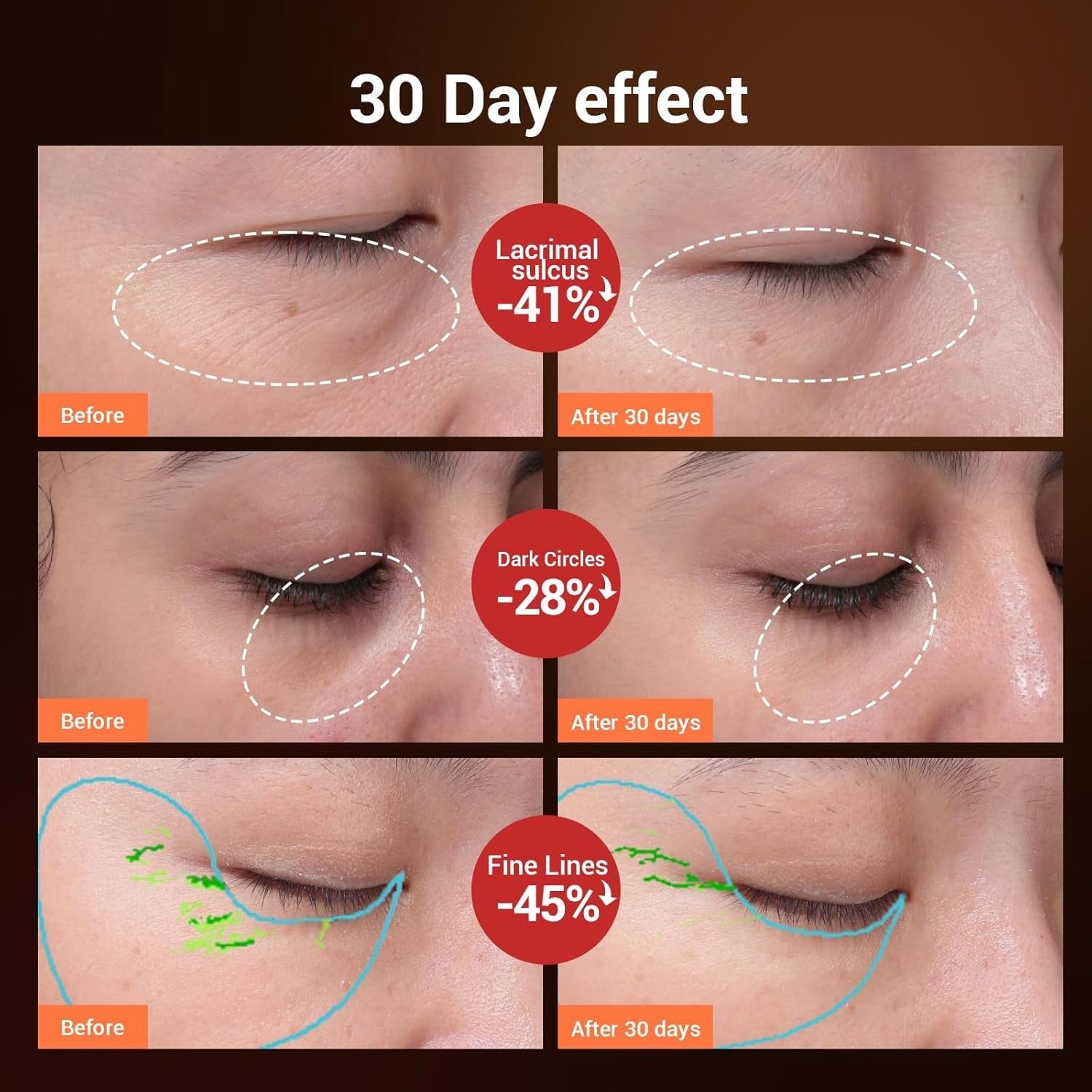 Heated Eye Massager 40℃ Sonic Vibration Red Light Anti Aging USB