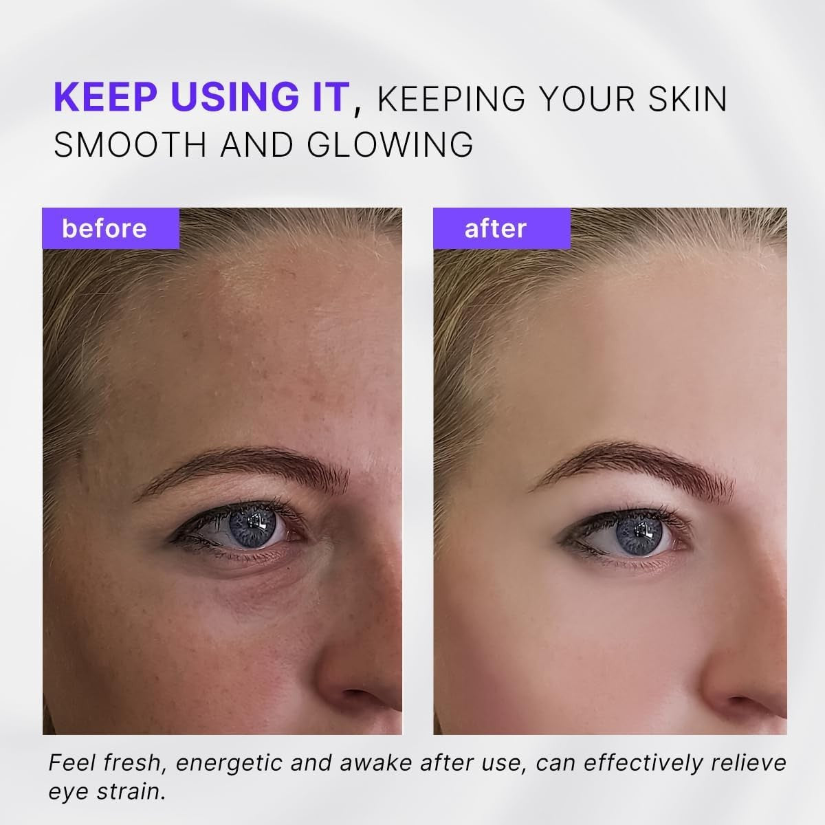 2 in 1 Eye Cream Applicator Ice Roller Puffiness Wrinkle