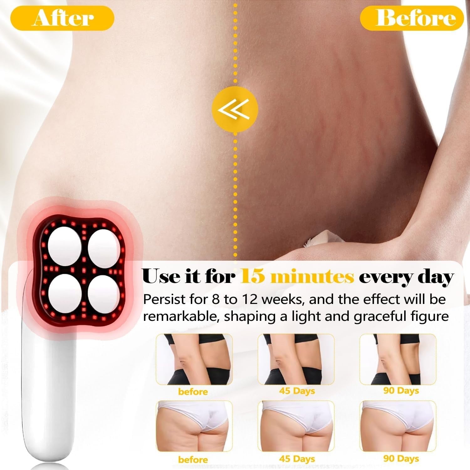 Wireless Cellulite Massager with Heat & Vibration for Belly, Waist, Arms, Legs S
