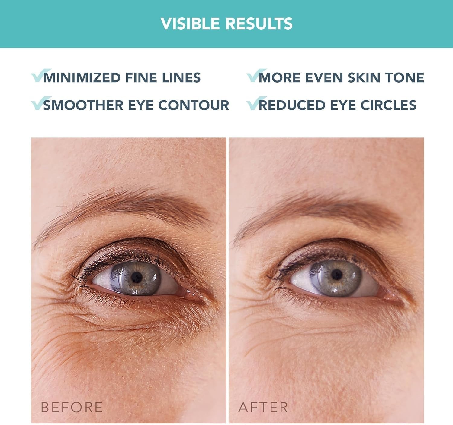 Eye Massager Lymphatic Drainage + 60 Hydrogel Eye Masks