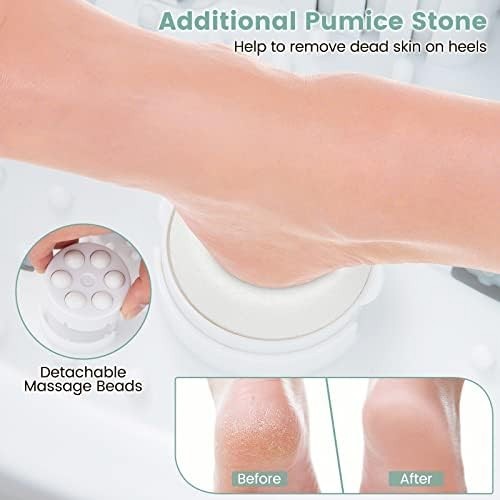 Foot Spa Massager with Heat, Bubbles & Vibration, 12 Rollers Foot Bath