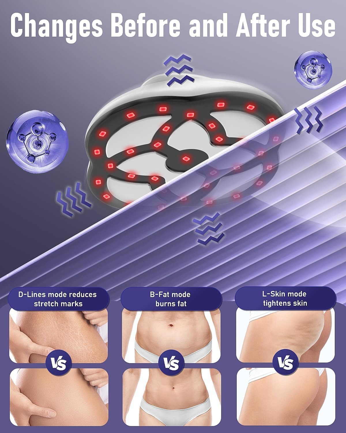 Portable Anti-Cellulite Massager with Heat, 15 Intensity Levels for Body Pain