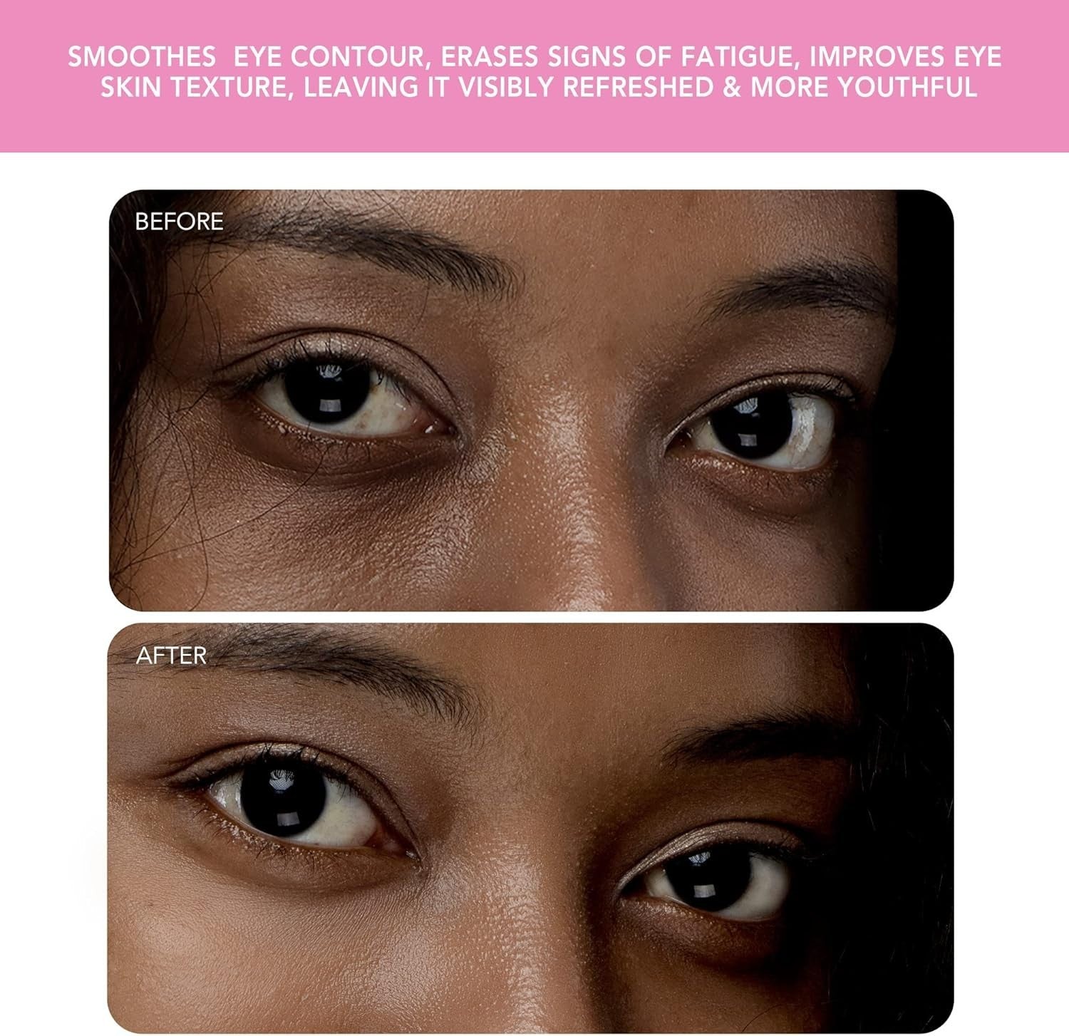 T-Sonic Eye Massager Lymphatic Drainage Dark Circles Pink