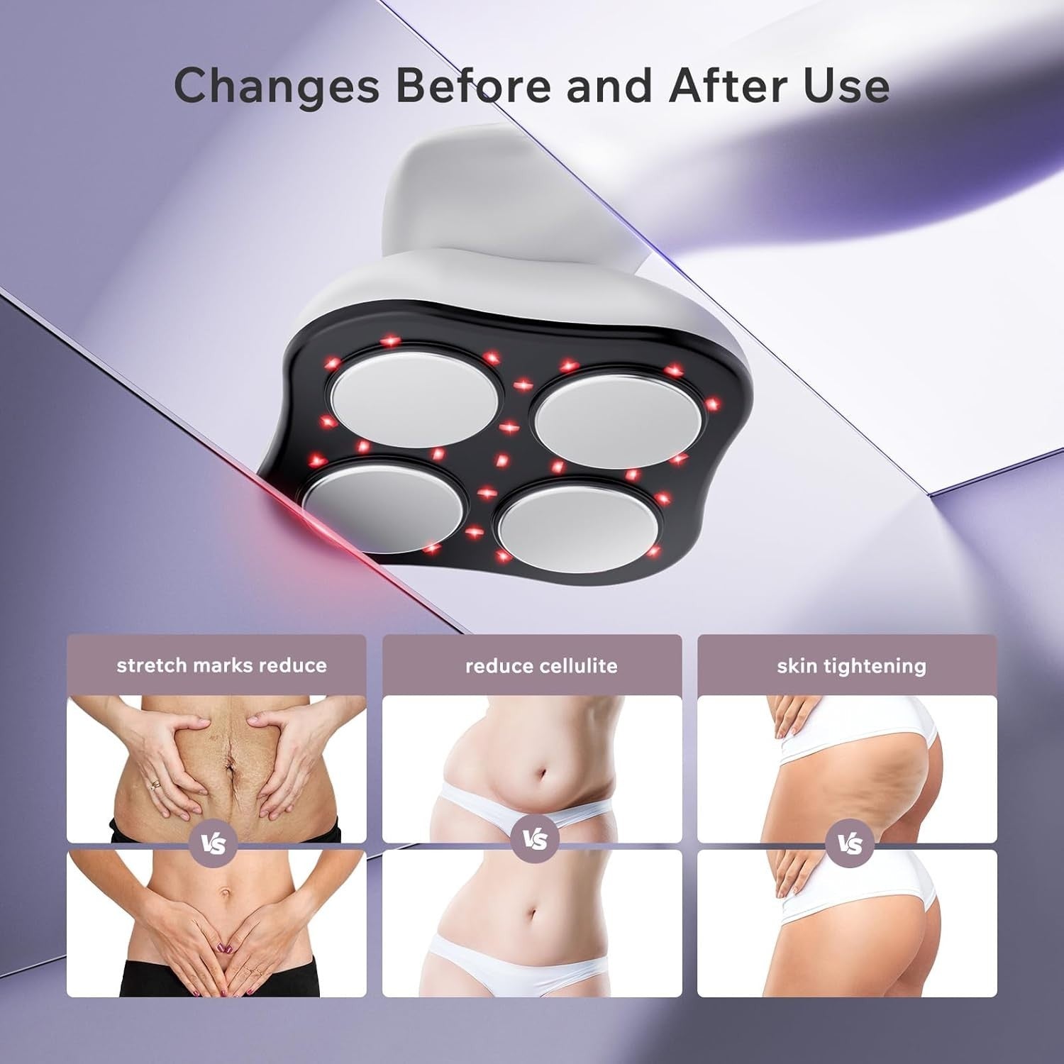 Cellulite Massager Heated Body Sculpting Fat Remover Skin Tightening Tool