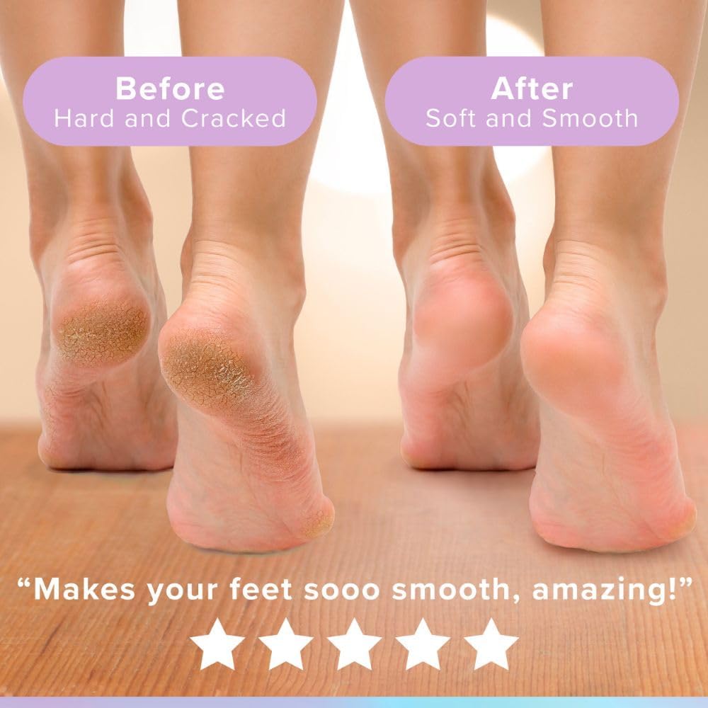 Foot Care Pedicure Kit Callus Remover Heel Repair Scrub Cream