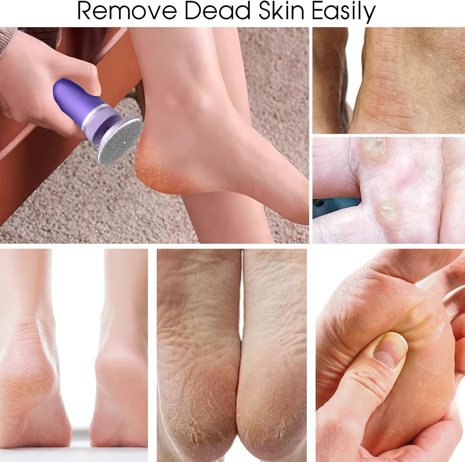 Electric Foot Callus Remover 12 Speed Rechargeable Pedicure