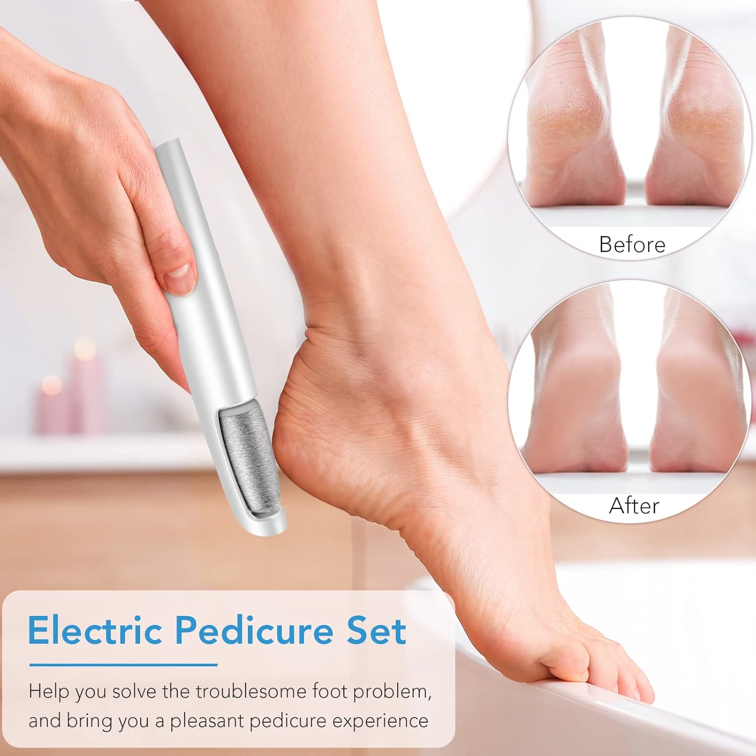 Electric Callus Remover Foot Scrubber Pedicure Tool Rechargeable