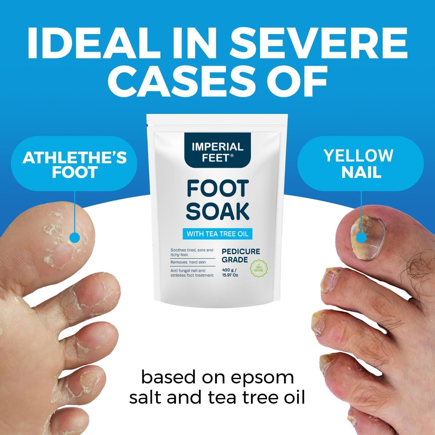 Heated Foot Spa Soak Epsom Salt Tea Tree Oil Pedicure Kit Rollers